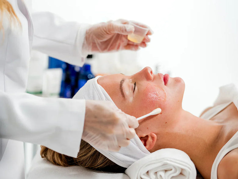 Everything You Need to Know About Chemical Peels