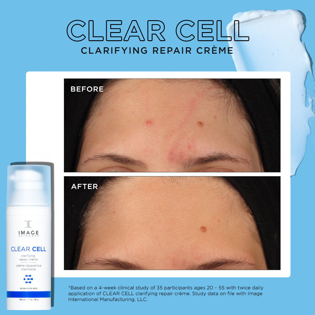 CLEAR CELL clarifying repair crème before and after showing results after 4 weeks