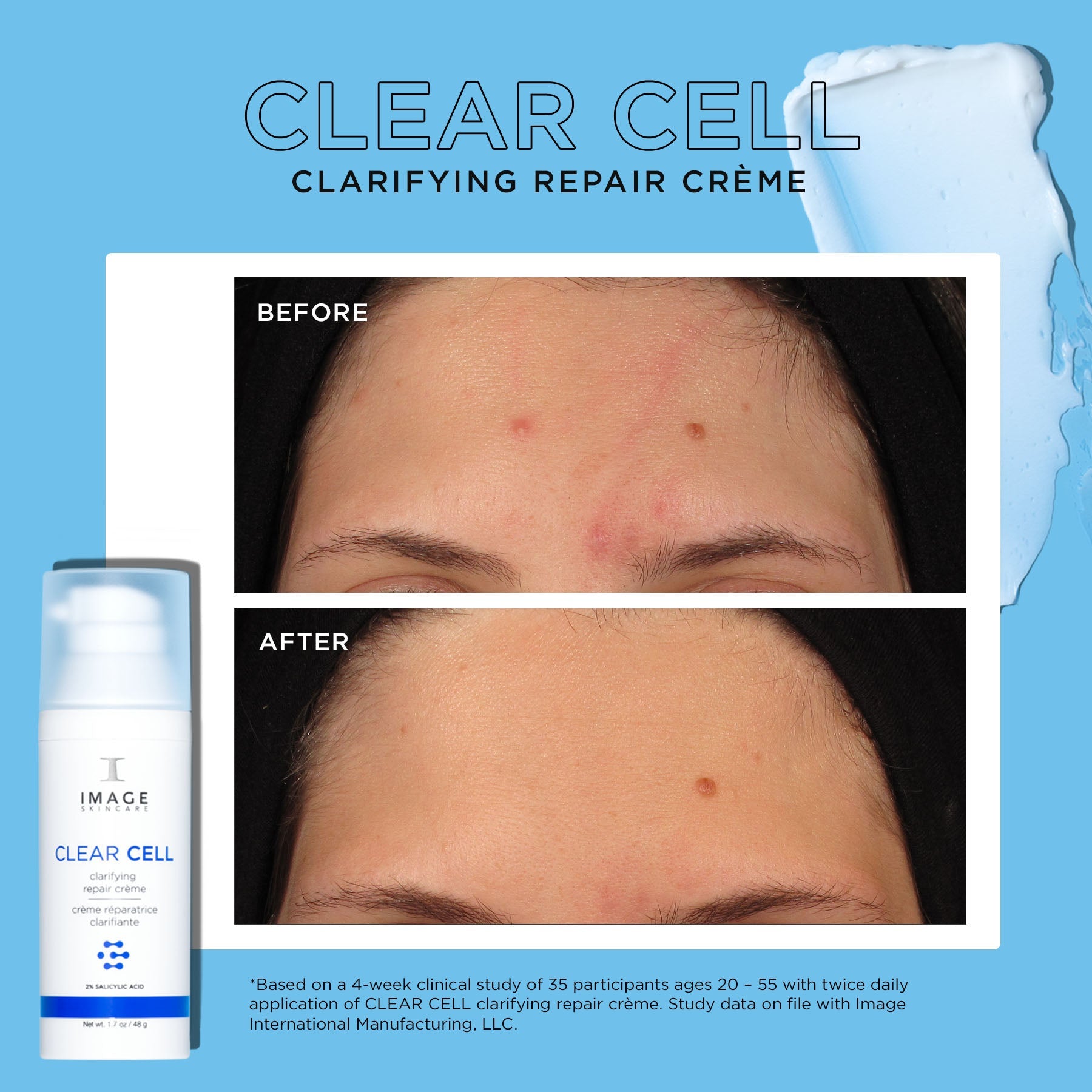 CLEAR CELL clarifying repair crème  before and after images showing results after 4 weeks