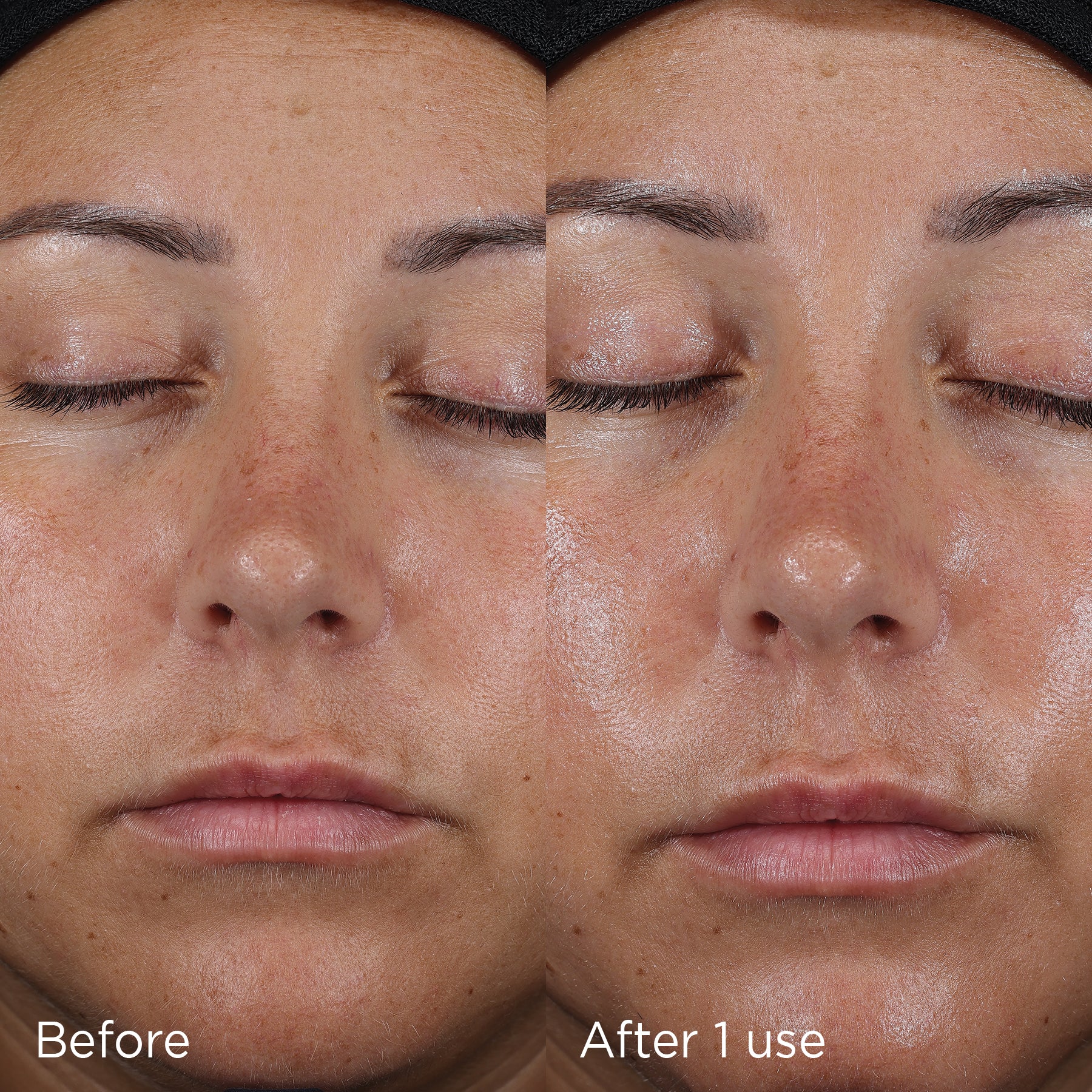 Before and after model shot showing results after 1 use