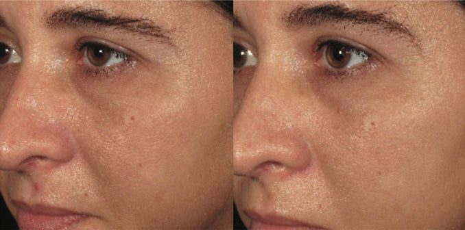 ORMEDIC balancing bio-peptide crème