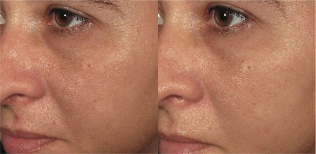 ORMEDIC balancing biopeptide crème