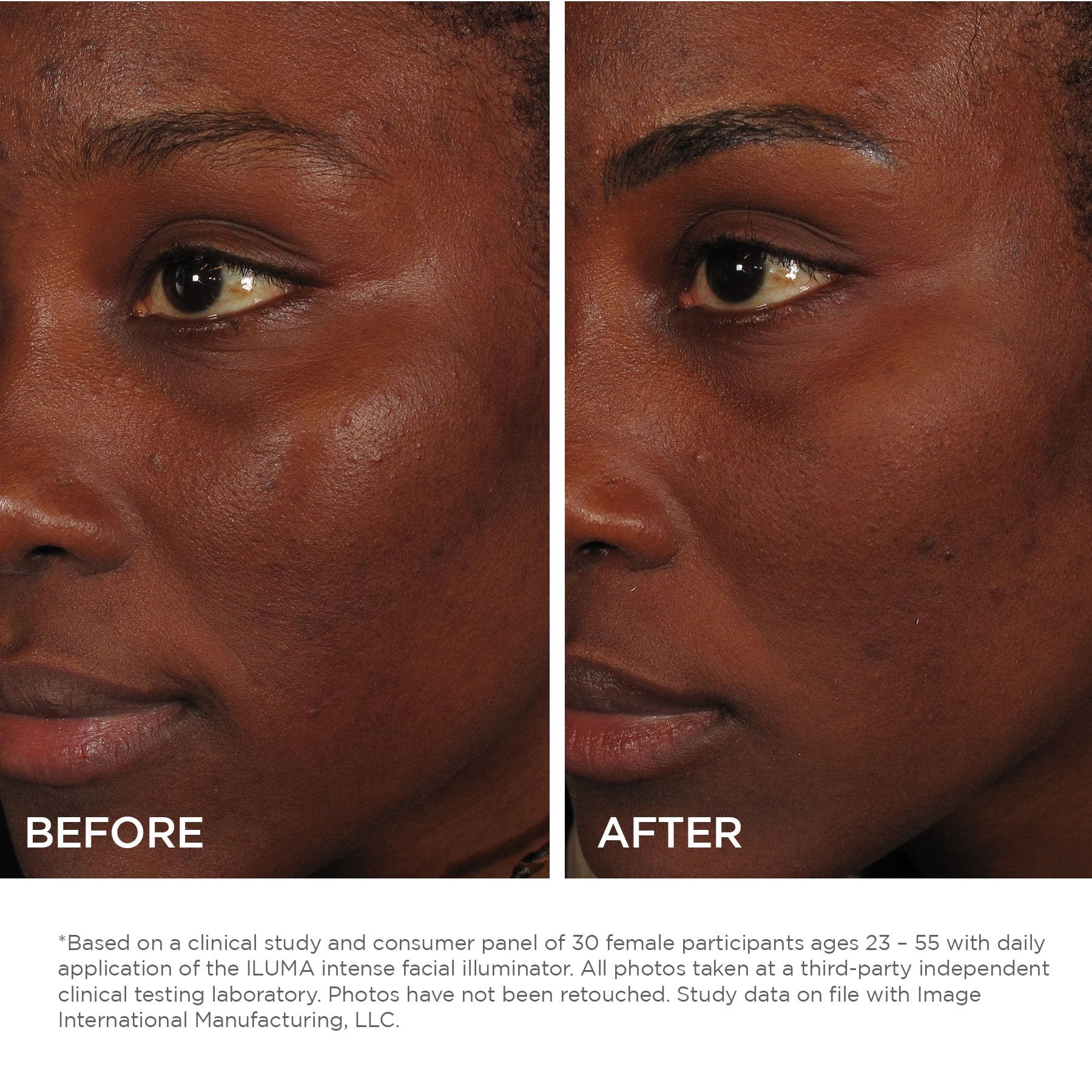 Before and after image of model face showing results