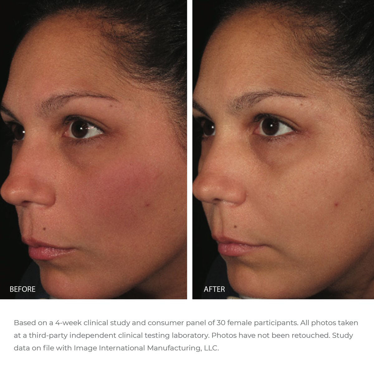 Before and after pictures of the results of the ORMEDIC antioxidant serum after 4 weeks