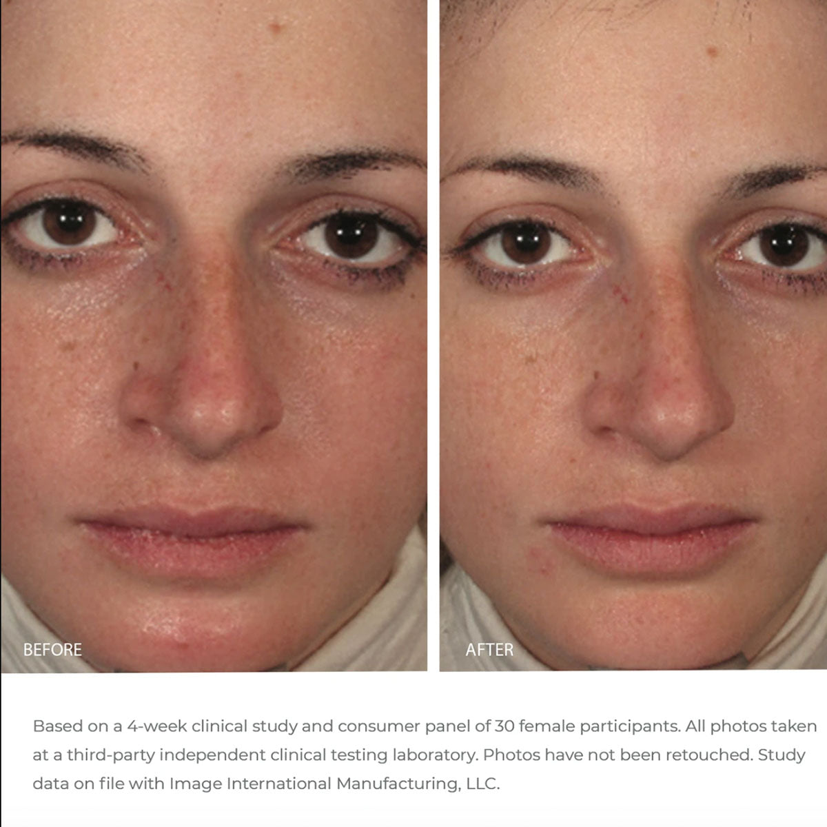 Before and after images of model face showing results after 4 weeks