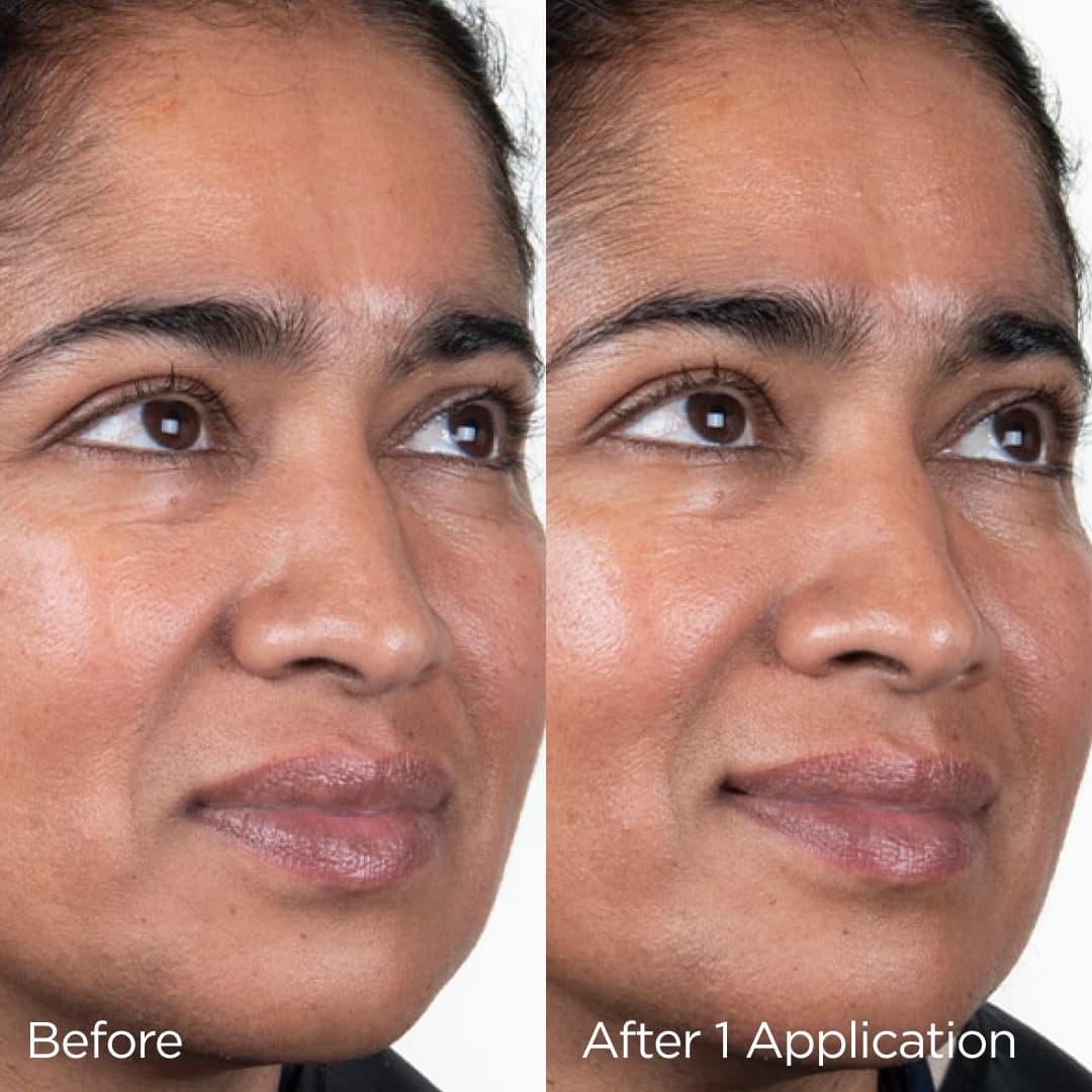 before and after images of client showing results